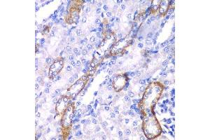 Immunohistochemistry of paraffin-embedded rat kidney using MYO1C antibody. (Myosin IC antibody  (AA 769-1028))