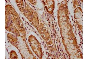 PIP4K2C antibody  (AA 127-408)