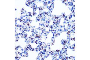 Immunohistochemistry of paraffin-embedded rat lung using Monoamine Oxidase B (MAOB) (MAOB) Rabbit mAb (ABIN7268682) at dilution of 1:100 (40x lens). (Monoamine Oxidase B antibody)