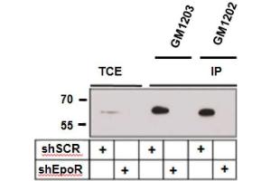 Immunoprecipitation of EpoR with and from A549 lung carcinoma cells expressing control (shSCR) and three EpoR-specific small hairpin RNAs (shEpoR). (EPOR antibody)