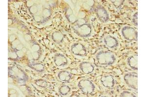 Immunohistochemistry of paraffin-embedded human small intestine tissue using ABIN7172654 at dilution of 1:100 (SPIC antibody  (AA 1-248))