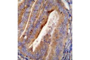 Immunohistochemistry analysis in formalin fixed and paraffin embedded human uterus tissue reacted with OGN Antibody (C-term)  followed by peroxidase conjugation of the secondary antibody and DAB staining. (OGN antibody  (C-Term))