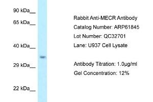 Western Blotting (WB) image for anti-Mitochondrial Trans-2-Enoyl-CoA Reductase (MECR) (C-Term) antibody (ABIN2774325) (MECR antibody  (C-Term))