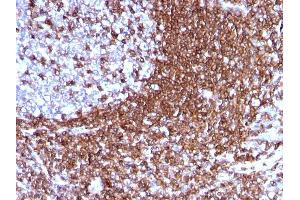 Formalin-fixed, paraffin-embedded human Tonsil stained with CD50 Mouse Monoclonal Antibody (186-2G9). (ICAM-3/CD50 antibody)