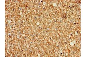 Immunohistochemistry of paraffin-embedded human brain tissue using ABIN7159980 at dilution of 1:100 (MAPK11 antibody  (AA 310-362))