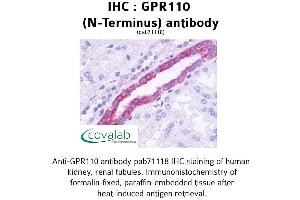 Image no. 1 for anti-G Protein-Coupled Receptor 110 (GPR110) (Extracellular Domain), (N-Term) antibody (ABIN1734904) (G Protein-Coupled Receptor 110 antibody  (Extracellular Domain, N-Term))