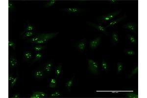 Immunofluorescence of purified MaxPab antibody to TSPYL6 on HeLa cell. (TSPY-Like 6 antibody  (AA 1-410))