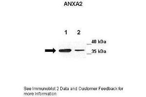 Lanes:   Lane 1: 20ug mouse GL261 cell lysate Lane 2: 20ug mouse astrocyte cell lysate  Primary Antibody Dilution:   1:250  Secondary Antibody:   Anti-rabbit-HRP  Secondary Antibody Dilution:   1:500  Gene Name:   ANXA2  Submitted by:   Anonymous (Annexin A2 antibody  (C-Term))