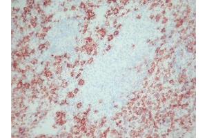 Immunohistochemistry (IHC) image for anti-Macrophages antibody (ABIN781726) (Macrophages antibody)