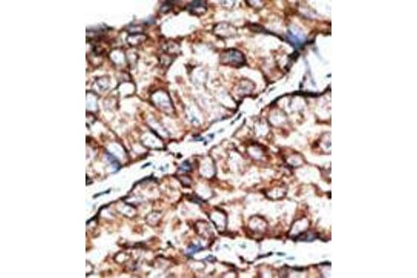 Dickkopf-Like 1 (DKKL1) (C-Term) antibody