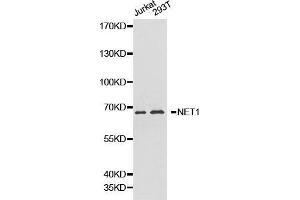 Western blot analysis of Jurkat cell and 293T cell lysate using NET1 antibody. (NET1 antibody  (AA 1-300))