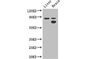 Western Blot Positive WB detected in: Mouse liver tissue, Mouse brain tissue All lanes: SMURF1 antibody at 3. (SMURF1 antibody  (AA 198-374))