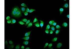 Immunofluorescence staining of Hela cells with ABIN7167118 at 1:133, counter-stained with DAPI. (RIN3 antibody  (AA 245-465))