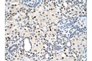 Immunohistochemistry with Tonsil tissue at an antibody concentration of 5µg/ml using anti-PSME3 antibody (ARP46142_P050) (PSME3 antibody  (N-Term))