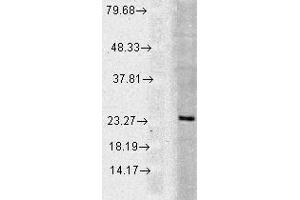 WB 1 in 1000 Huma Cell line mix 20ug Rab5. (RAB5 antibody)