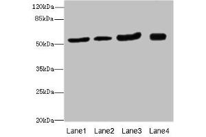 Western blot All lanes: ANTXR2antibody at 1. (ANTXR2 antibody  (AA 340-489))