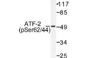 Image no. 1 for anti-Activating Transcription Factor 2 (ATF2) (pSer44), (pSer62) antibody (ABIN317964) (ATF2 antibody  (pSer44, pSer62))