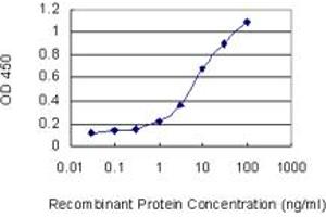 Detection limit for recombinant GST tagged SLC22A12 is 0.