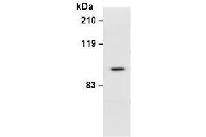 Western Blotting (WB) image for anti-Integrin beta 3 (ITGB3) antibody (ABIN1449278) (Integrin beta 3 antibody)