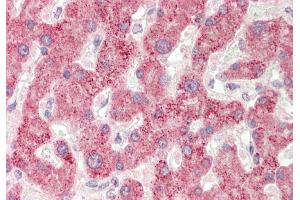 Rabbit Anti-BAAT antibody  Formalin Fixed Paraffin Embedded Tissue: Human Liver Primary antibody Concentration: 1:100 Secondary Antibody: Donkey anti-Rabbit-Cy3 Secondary Antibody Concentration: 1:200 Magnification: 20x Exposure Time: 0. (BAAT antibody  (N-Term))