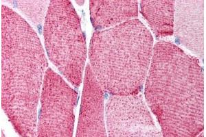 Immunohistochemistry (Paraffin-embedded Sections) (IHC (p)) image for anti-Histone Deacetylase 6 (HDAC6) (AA 69-118) antibody (ABIN6736396)