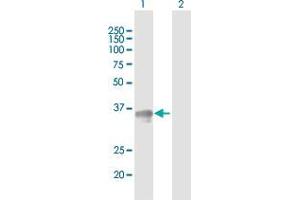 Western Blot analysis of SGCG expression in transfected 293T cell line by SGCG MaxPab polyclonal antibody. (SGCG antibody  (AA 1-291))