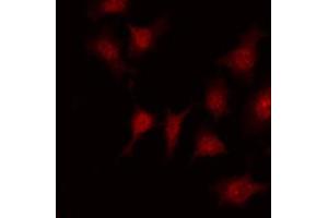 ABIN6267688 staining Hela by IF/ICC. (DOK1 antibody  (pTyr398))