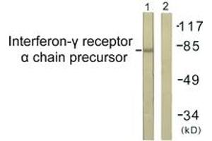 Western blot analysis of extracts from COS7 cells, using Interferon-gamma Receptor alpha chain (Ab-457) Antibody. (IFNGR1 antibody  (AA 431-480))