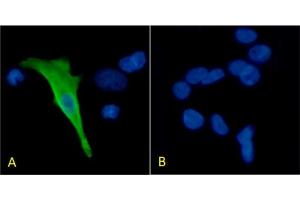 Immunofluorescence staining of HEK293 cells with Anti-Protein C (ABIN7487753) HPC-4 Immunofluorescence analysis of paraformaldehyde fixed HEK293 cells transfected with Protein C expressing plasmid (A) and non-transfected HEK293 cells (B), permeabilized with 0. (Recombinant PROC antibody)