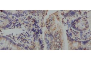 Immunohistochemistry of paraffin-embedded Mouse colon using IL10 Polyclonal Antibody at dilution of 1:50 (IL-10 antibody)