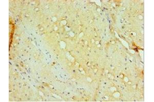 Immunohistochemistry of paraffin-embedded human small intestine tissue using ABIN7143885 at dilution of 1:100 (aHSP antibody  (AA 1-102))