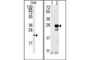Image no. 1 for anti-GTPase NRas (NRAS) (N-Term) antibody (ABIN360038) (GTPase NRas antibody  (N-Term))