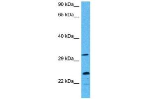 Host:  Mouse  Target Name:  AK2  Sample Tissue:  Mouse Testis  Antibody Dilution:  1ug/ml (Adenylate Kinase 2 antibody  (Middle Region))