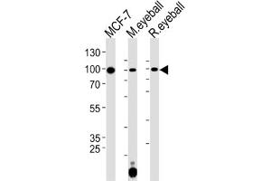 Western Blotting (WB) image for anti-Collagen, Type IX, alpha 1 (COL9A1) antibody (ABIN3001615)