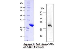 Image no. 2 for Sepiapterin Reductase (SPR) (AA 1-261) protein (Strep Tag) (ABIN3097469)