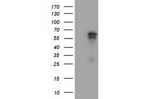 HEK293T cells were transfected with the pCMV6-ENTRY control (Left lane) or pCMV6-ENTRY ACD (Right lane) cDNA for 48 hrs and lysed. (ACD antibody)