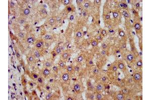 IHC image of ABIN7149912 diluted at 1:300 and staining in paraffin-embedded human liver tissue performed on a Leica BondTM system. (DLST antibody  (AA 76-225))