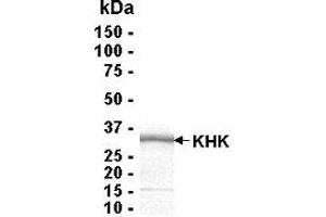 Western Blotting (WB) image for Ketohexokinase (KHK) (AA 1-298) protein (ABIN2468740)