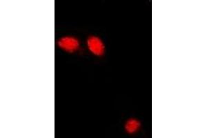 Immunofluorescent analysis of Troponin C staining in U2OS cells. (Troponin C antibody)