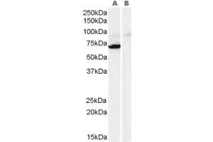 Western Blotting (WB) image for anti-gamma-Glutamylamine Cyclotransferase (GGACT) (C-Term) antibody (ABIN2790894) (GGACT antibody  (C-Term))