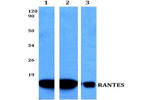 Western blot (WB) analysis of RANTES Antibody at 1/500 dilution. (CCL5 antibody)