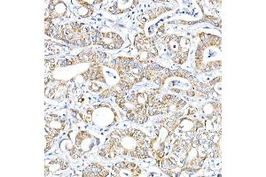 Immunohistochemistry of paraffin-embedded Human liver using RMDN3 Rabbit pAb (ABIN6127274, ABIN6146979, ABIN6146981 and ABIN6221512) at dilution of 1:100 (40x lens). (RMDN3 antibody  (AA 171-470))