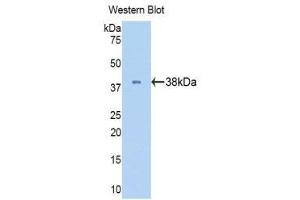 Western Blotting (WB) image for anti-Lactate Dehydrogenase B (LDHB) (AA 1-334) antibody (ABIN1174942)