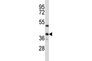 ERCC1 antibody western blot analysis in T47D lysate (ERCC1 antibody  (AA 268-297))