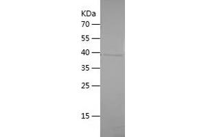 Western Blotting (WB) image for Tumor Necrosis Factor (Ligand) Superfamily, Member 14 (TNFSF14) (AA 71-240) protein (His-IF2DI Tag) (ABIN7125530) (TNFSF14 Protein (AA 71-240) (His-IF2DI Tag))
