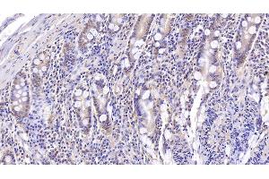 Detection of PLOD3 in Human Small intestine Tissue using Polyclonal Antibody to Procollagen Lysine-2-Oxoglutarate-5-Dioxygenase 3 (PLOD3) (PLOD3 antibody  (AA 647-738))