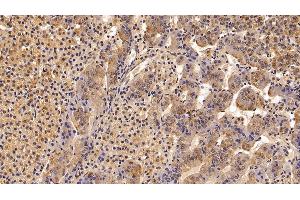 Detection of TBG in Porcine Adrenal gland Tissue using Polyclonal Antibody to Thyroxine Binding Globulin (TBG) (SERPINA7 antibody  (AA 128-415))