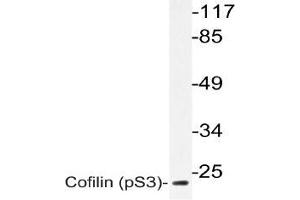 Western blot (WB) analyzes of p-Cofilin antbody in extracts from 3T3 paclitaxel cells. (Cofilin antibody  (pSer3))