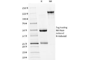 SDS-PAGE Analysis Purified p53 Mouse Monoclonal Antibody (PAb240). (p53 antibody  (AA 14-389))
