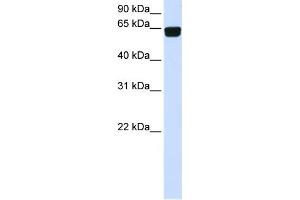 WB Suggested Anti-PIGT Antibody Titration:  0. (PIGT antibody  (C-Term))